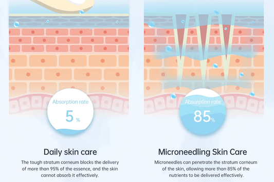 The Science Behind Dr. Pen Microneedling Pen: How It Stimulates Collagen Production