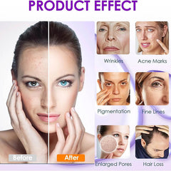 Microneedling Needles Replacement Needle Cartridges for Dr.Pen A10