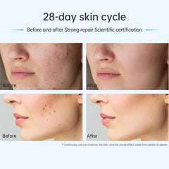 Dr. Pen A11 Ultima Pro Microneedling Pen including 10 Pcs Replacement Cartridges