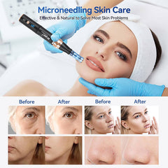 Professional Derma Pen A8S, Wireless Dr.pen A8S with 6 Speeds, Electric Dermapen with 8pcs Cartridges Replacement (12PIN 36PIN), 0.25-2.5mm Adjustable