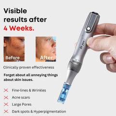 Dr Pen M8S Auto Microneedling Pen - Including 12 Pcs Replacement Cartridges