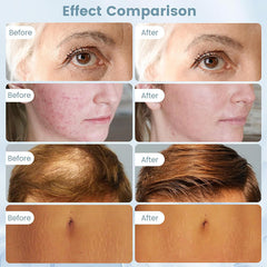 Dr.pen Microneedling, Upgraded 2 IN 1 wireless Dermapen Hydra Pen H3 with 6 Pcs 12PIN Replacement Cartridges Needles, 6 Speed Levels 0-1.0 mm Depth Adjustable